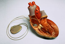 Kardiologie Bonn